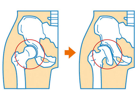 病院 股関節 専門