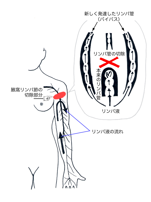 リンパ 浮腫 マッサージ